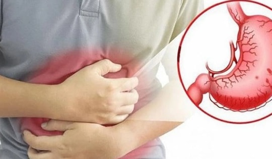 Người đàn ông 38 tuổi ở Phú Thọ thủng dạ dày vì thói quen chữa bệnh xương khớp nhiều người Việt mắc phải