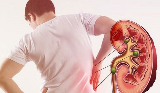 Ai có nguy cơ bị suy thận cấp?