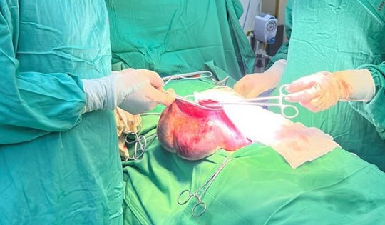 Bé gái 15 tuổi có khối u buồng trứng ác tính, dấu hiệu nào giúp cha mẹ nhận biết?