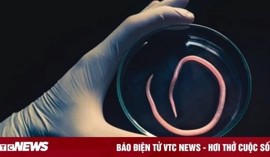 6 loại giun sán ký sinh trong cơ thể người phụ nữ