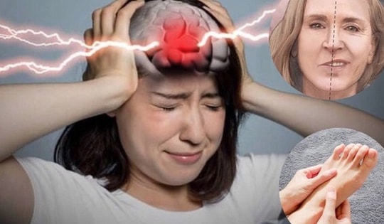 Người phụ nữ 62 tuổi ở Phú Thọ đang khỏe mạnh, bất ngờ bị nhồi máu não sau dấu hiệu phổ biến này