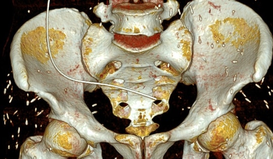 Người đàn ông ở Phú Thọ phát hiện sán ký sinh khắp cơ thể do sai lầm trong ăn uống, người Việt mắc phải hàng ngày