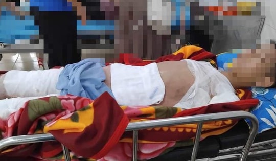 Nam sinh 11 tuổi ở Tuyên Quang phải đi cấp cứu với vết thương vùng kín nặng nề do tai nạn không ngờ tới