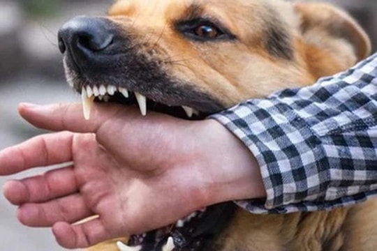 Hai người trong gia đình bị chó dại cắn, một người tử vong