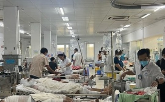 Tình hình sức khoẻ 9 công nhân bị bỏng trong vụ nổ công ty gỗ ở Bình Dương