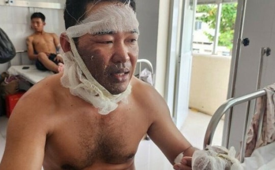 Công nhân vụ nổ nhà máy gỗ: 'Lửa như quả cầu phụt xa hàng chục mét'