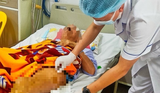 Thay khớp háng thành công cho cụ ông 71 tuổi bị xơ gan nặng