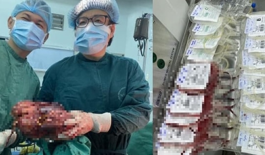 Quyết định kịp thời của bác sĩ cứu sống nam thanh niên 26 tuổi mắc ung thư gan