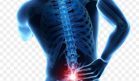 Thoát vị đĩa đệm: Nguyên nhân, biểu hiện, cách điều trị và phòng bệnh