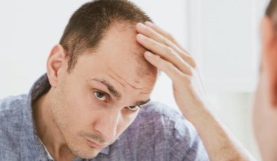 Thủ dâm gây rụng tóc, đúng hay sai?