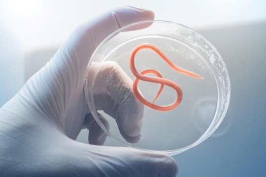 Giun, sán làm tổ khắp người vì thói quen ăn rau sống, ngủ với thú cưng