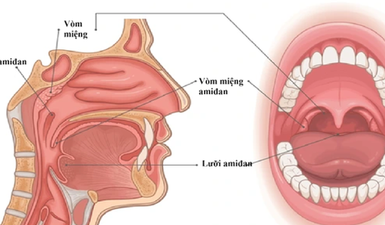 Các phương pháp điều trị viêm VA ở trẻ nhỏ