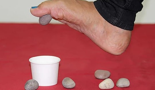 Bài tập phục hồi cho người bệnh bàn chân bẹt