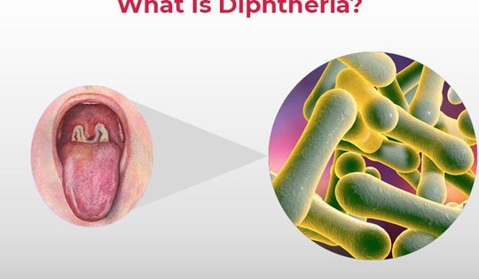 Bệnh bạch hầu có lây truyền qua đường tình dục?