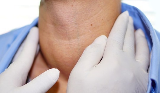 Các phương pháp điều trị bướu cổ