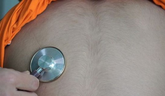 Bé 6 tuổi ở Phú Thọ người mọc đầy lông vì cha mẹ cho con dùng thuốc theo cách này