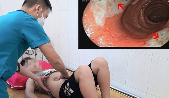 Bé 9 tuổi ở Phú Thọ bị loét hành tá tràng do cha mẹ cho dùng thuốc hạ sốt sai cách