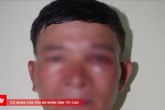 Lừa đảo chiếm đoạt xe máy tại nhà xe bệnh viện