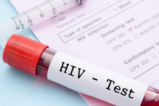 Những ai được tiếp cận thông tin người nhiễm HIV?