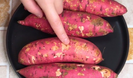 Ăn khoai lang để giảm cân sai cách, cô gái 26 tuổi suy sụp phát hiện ung thư gan, bác sĩ chỉ rõ sai lầm nguy hiểm này