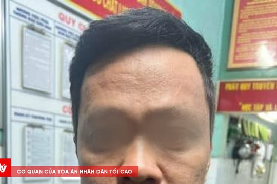 TP.HCM: Truy xét, bắt nhanh các đối tượng cướp giật tài sản