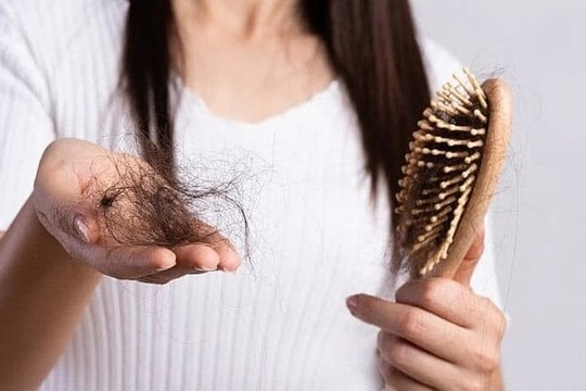 Càng gội đầu tóc càng rụng 'như lá mùa thu', đâu là nguyên nhân?