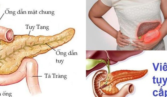 Người đàn ông ở Phú Thọ nhập viện gấp vì mỡ máu cao gấp 50 lần, bác sĩ khuyến cáo từ bỏ ngay thói quen này