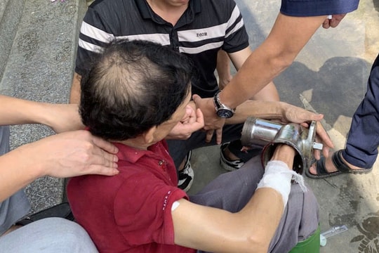 Người đàn ông đến viện cấp cứu với bàn tay kẹt trong máy xay thịt