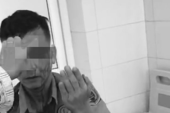 Bảo vệ Bệnh viện K bị hành hung, phải khâu 8 mũi