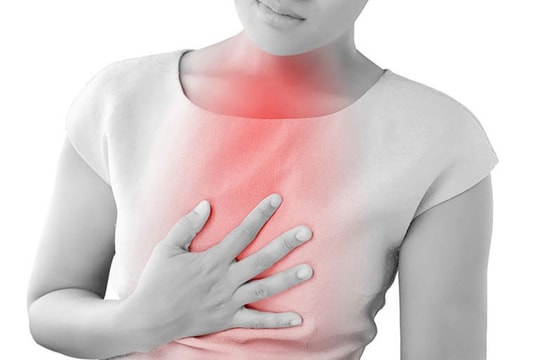 Đừng xẹm nhẹ trào ngược dạ dày thực quản, cẩn thận mắc ung thư