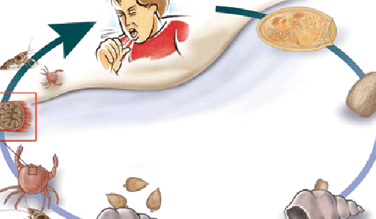 Nam thanh niên ở Sơn La thường xuyên ho ra máu từ thói quen nhiều người hay mắc phải