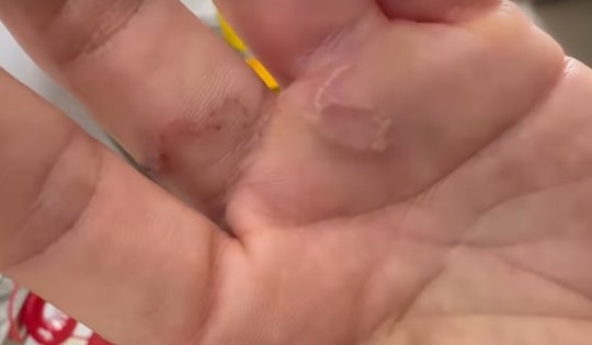 Nuôi 8 con chó, mèo, người phụ nữ 42 tuổi ở Vĩnh Phúc phải nhập viện vì lý do này