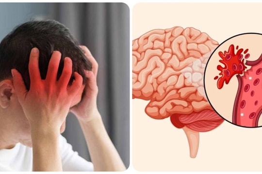 6 thói quen xấu dễ gây đột quỵ mùa hè, nhiều người không biết vẫn làm