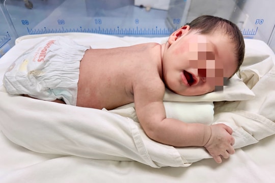 Cứu bé sơ sinh bị bỏ rơi với hàng trăm con giòi trên cơ thể