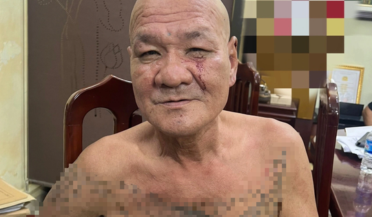 Khởi tố đối tượng chém gục người đàn ông trên phố Trần Quang Khải, Hà Nội