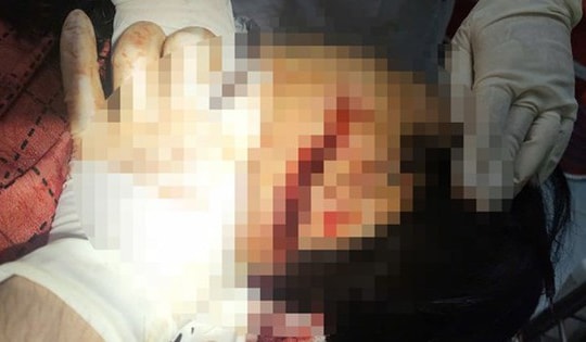 Chồng đánh vợ trọng thương rồi bỏ trốn