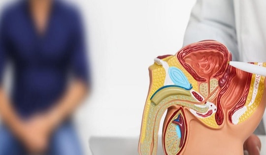 Thủ dâm gây vô sinh?