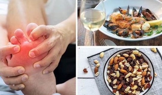 5 thực phẩm làm tăng nguy cơ acid uric gây bệnh gout