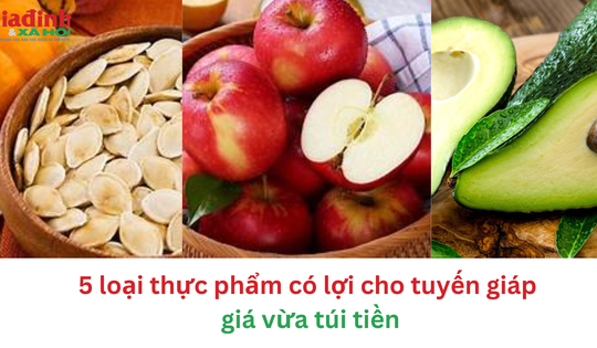 5 loại thực phẩm có lợi cho tuyến giáp giá vừa túi tiền