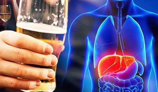 5 thói quen sinh hoạt gây ra bệnh gan nhiễm mỡ, thói quen số 1 nam giới Việt thường khó từ bỏ