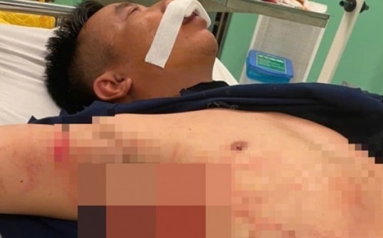 Thiếu tá công an bị chém trọng thương trong đêm