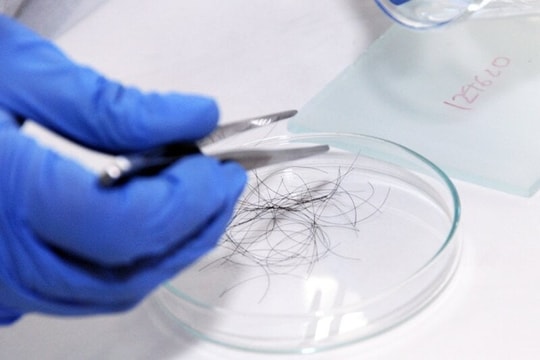 Phát hiện con trai khác nhóm máu, người đàn ông lập tức lấy tóc xét nghiệm ADN