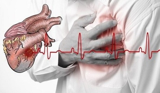 Người đàn ông 34 tuổi bị nhồi máu cơ tim cấp, bác sĩ cảnh báo thói quen nhiều đàn ông Việt hay mắc phải