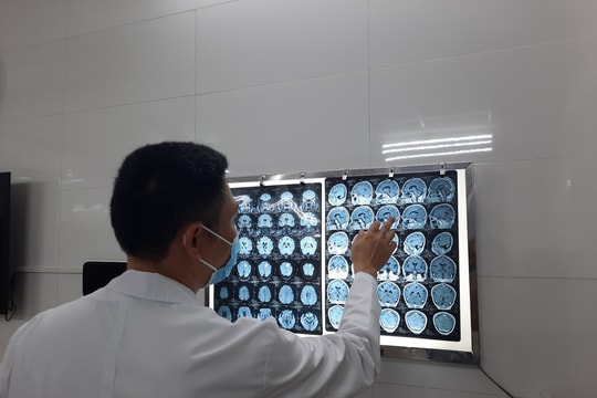 Co giật vì sán làm tổ trong não, 'thủ phạm' là món ăn khoái khẩu của nhiều người