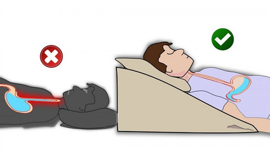 Giảm triệu chứng trào ngược dạ dày không dùng thuốc