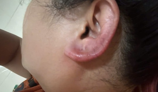 Khách hàng tố thẩm mỹ viện Berry Clinic vì phải nhập viện sau làm đẹp