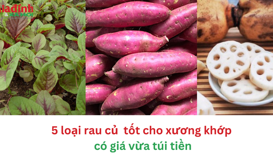 5 loại rau củ tốt cho xương khớp có giá siêu rẻ