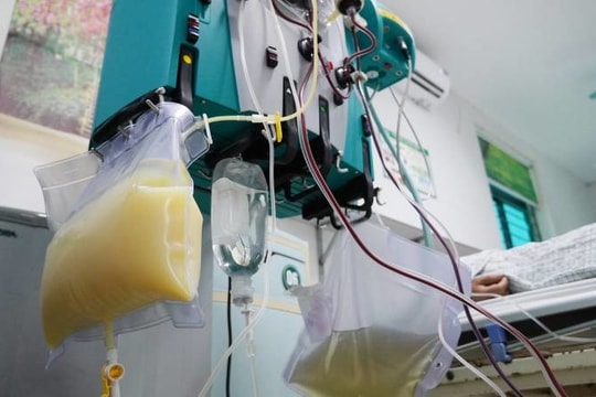 Lọc máu, thay huyết tương cho bệnh nhân viêm tụy cấp