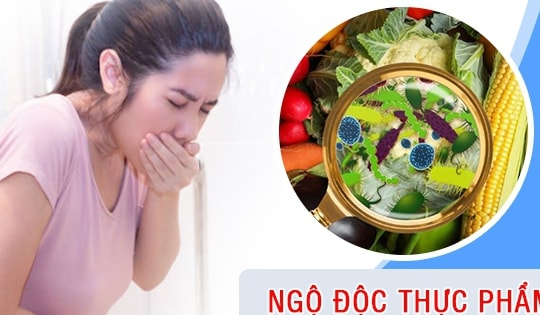 Các bài thuốc sơ cứu người bị ngộ độc thực phẩm đơn giản tại nhà