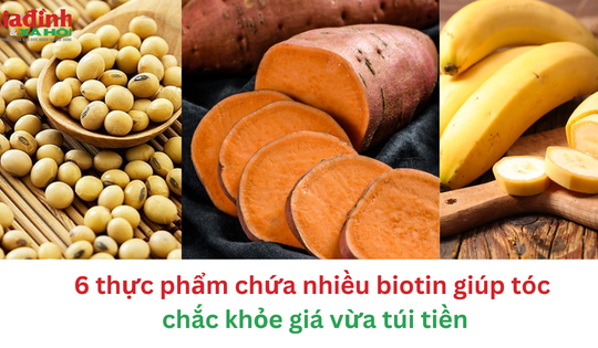 6 thực phẩm chứa nhiều biotin giúp tóc chắc khỏe lại rẻ tiền